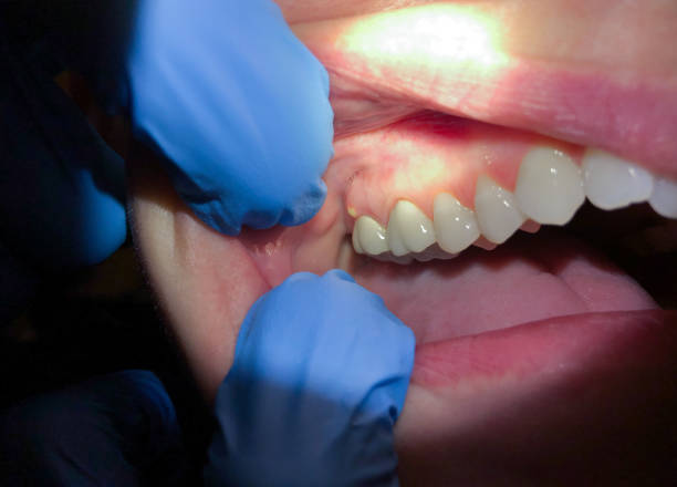 Best Tooth Infection Emergency Dentist  in Covington, KY